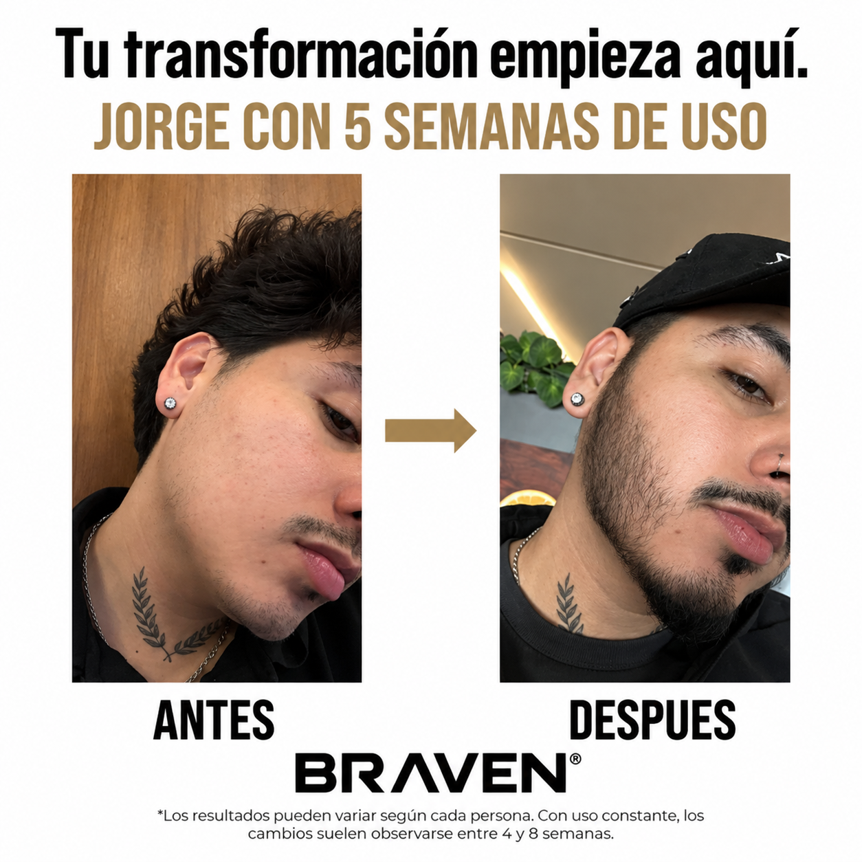 breven
