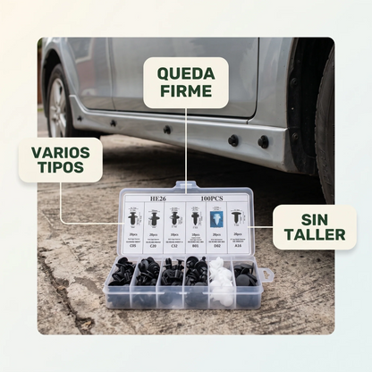 KIT DE CLIPS PARA AUTOMOTRICES – 100 Clips Automotrices